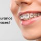 Can Insurance Cover Lasik? Find Out Here